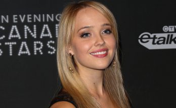 Siobhan Williams Without Cosmetics