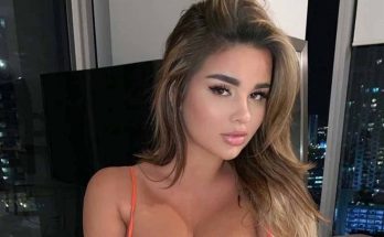 Anastasiya Kvitko Without Cosmetics